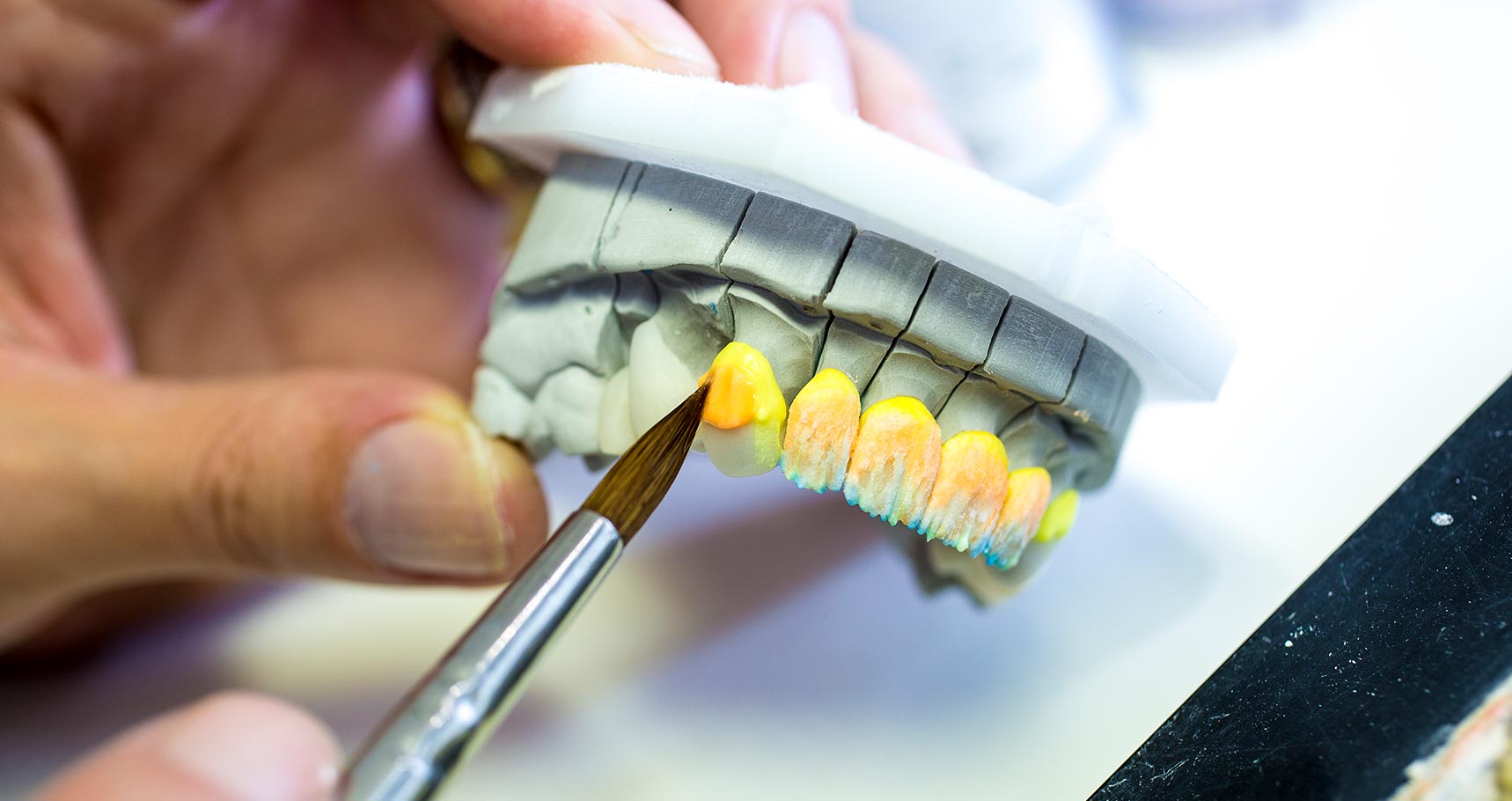 Hall Dental Studio | Manchester